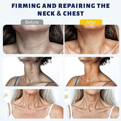 SOFTORASKIN™ 5-Roller Neck Firming Cream – Collagen & Hyaluronic Acid for Smoother, Tighter-Looking Neck Skin
