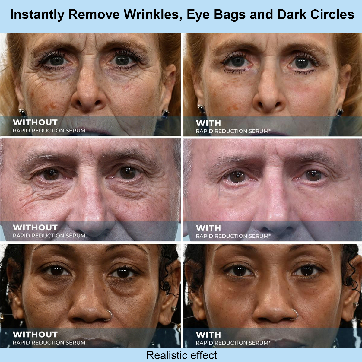 SOFTORASKIN™ Rapid Face Tightener – Look Refreshed & Firmer in 30 Seconds