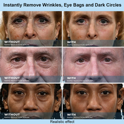 SOFTORASKIN™ Rapid Face Tightener – Look Refreshed & Firmer in 30 Seconds