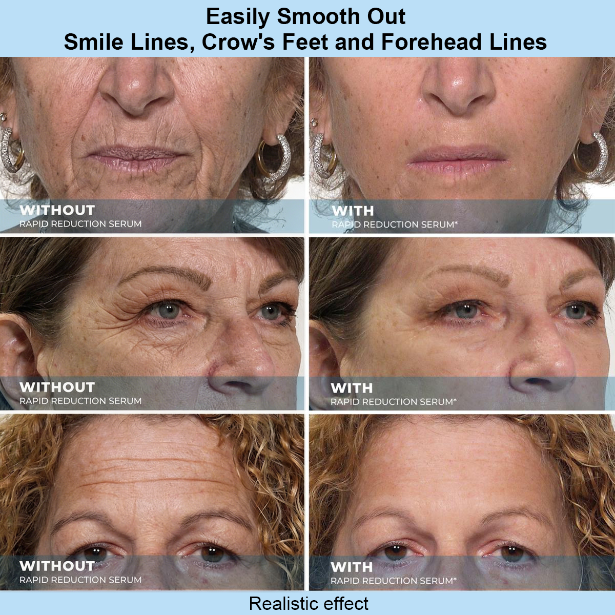 SOFTORASKIN™ Rapid Face Tightener – Look Refreshed & Firmer in 30 Seconds