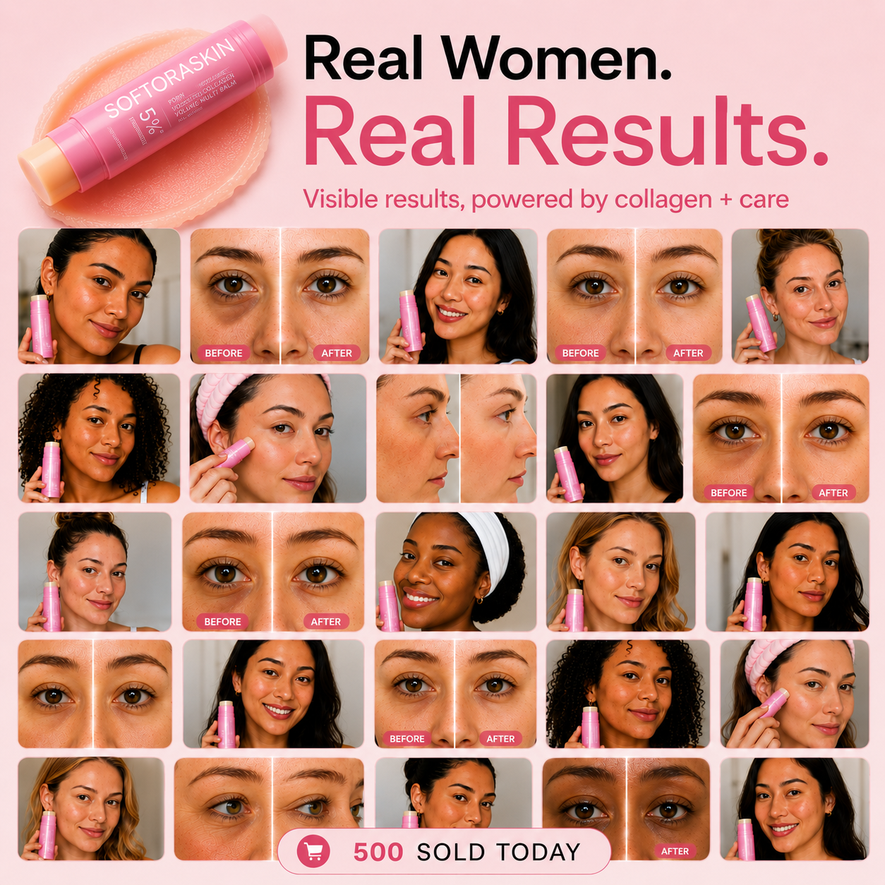 SOFTORASKIN™Collagen Face Balm