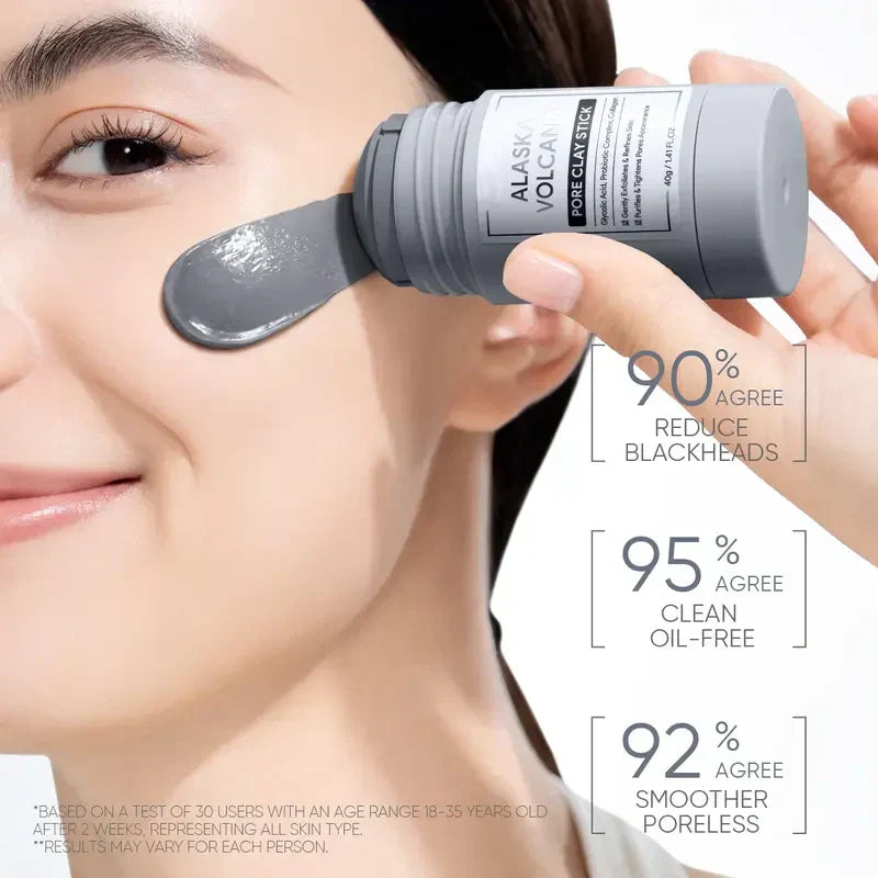 SOFTORASKIN Alaska Volcano Clay Stick – Blackhead Remover & Pore Cleanser