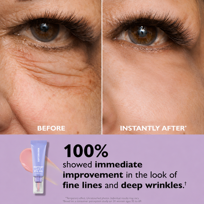 SOFTORASKIN™ Eye Bag Instant Eraser – Tightens, Smooths & Depuffs