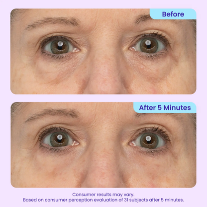 SOFTORASKIN™ Eye Bag Instant Eraser – Tightens, Smooths & Depuffs