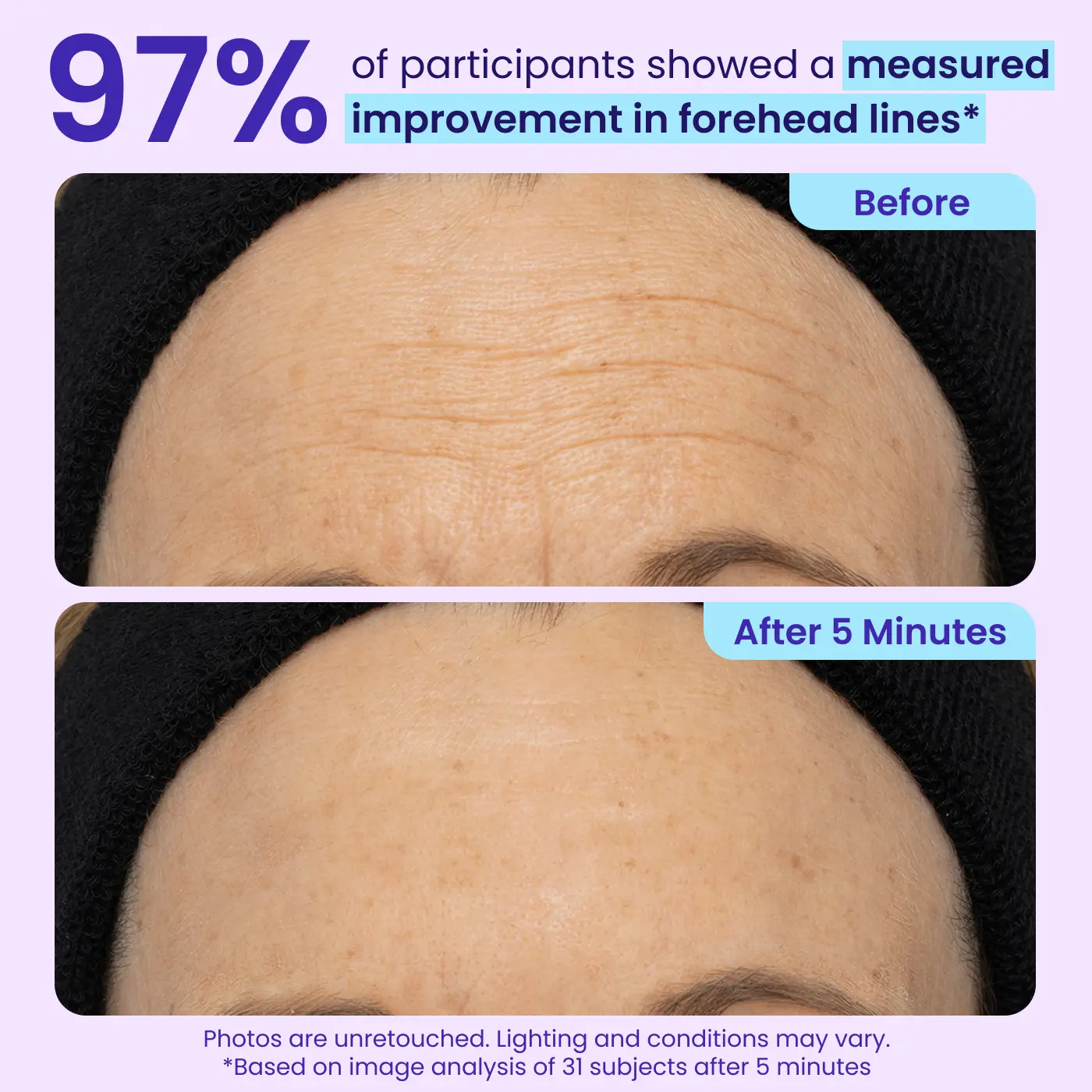 SOFTORASKIN™ Eye Bag Instant Eraser – Tightens, Smooths & Depuffs