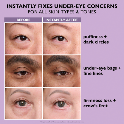 SOFTORASKIN™ Eye Bag Instant Eraser – Tightens, Smooths & Depuffs