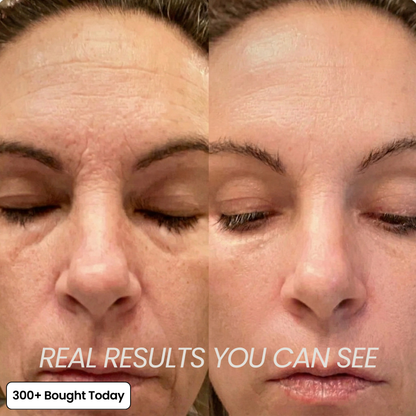 SoftoraSkin™ Plumping Glow Balm – Smooth Wrinkles & Restore Radiance