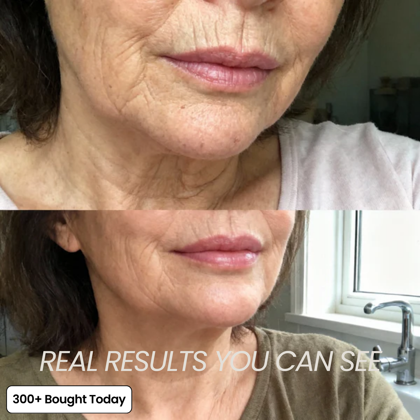 SoftoraSkin™ Plumping Glow Balm – Smooth Wrinkles & Restore Radiance