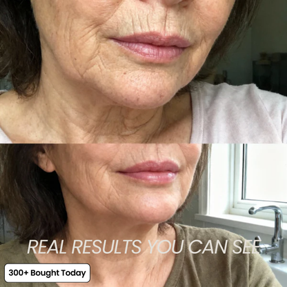 SoftoraSkin™ Plumping Glow Balm – Smooth Wrinkles & Restore Radiance