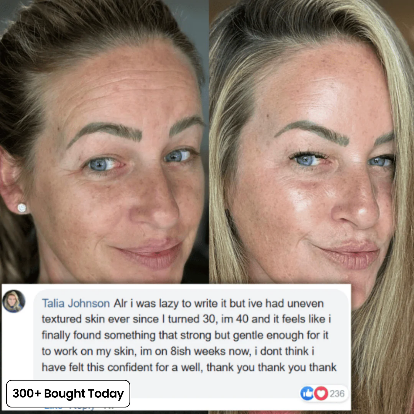 SoftoraSkin™ Plumping Glow Balm – Smooth Wrinkles & Restore Radiance