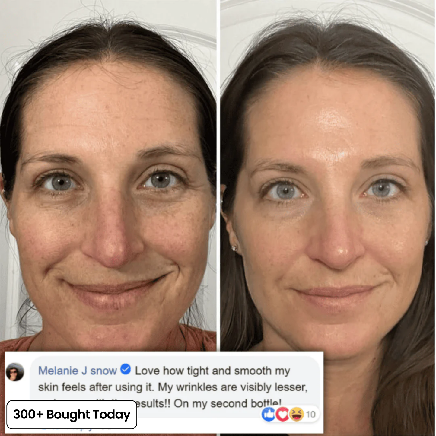 SoftoraSkin™ Plumping Glow Balm – Smooth Wrinkles & Restore Radiance